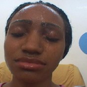 mf-3464-1 shock treatment