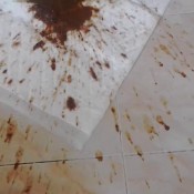 water enema and nasty diarrhea missanja