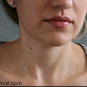 close up of my veins as i fart hd hd sparklyhots hot clips