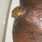 turd fest hd ebonyscatbbw