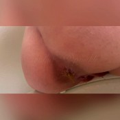 diarrhea destruction! sophia_sprinkle