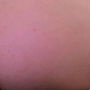 oh no diarrhea! hd badkithy