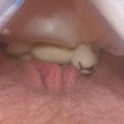 teddy pee and diaper poo biggest explosion hd poogirlsofia diapergirlsofia