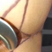 kinky anal speculum show hd imirisbabe