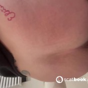 Amy_farts Nurse Has Explosive Diarrhea