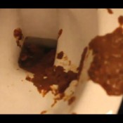 Toilet Diarrhees Peteuse