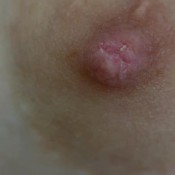 Look Into My Eyes, Look At My Lips, Nipples, Dirty Navel Alicetop