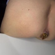 Thick Poo Stretch My Ass And Fall In Bathtub Dirty_kitty