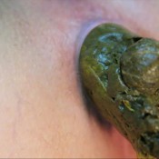 Loverachelle2 2 Poops In Hi-def