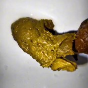 Voyeur Style Squat Pooping At Public Toilet Joy June