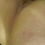 Lanalocks Diarrhea Lana Locks