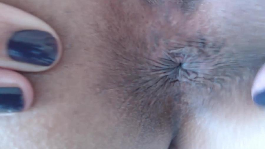 Goldenlace Ugly Ass Spread And Extreme Close Up